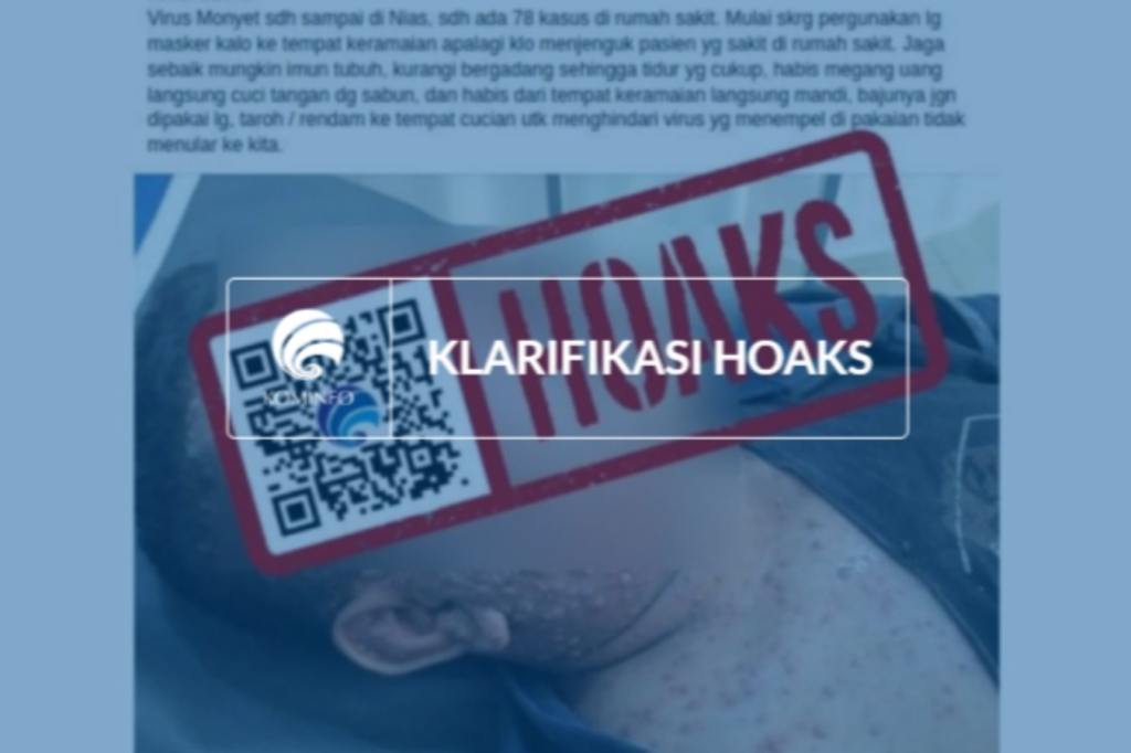 [HOAKS] Wabah Mpox Telah Menyebar di Kabupaten Nias pada September&nbsp;2024